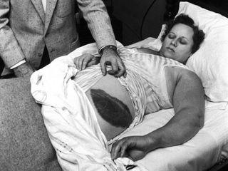 A meteorite crashed through the ceiling, deflected off Ann Hodges' stand-up console radio and hit her hip in 1954.